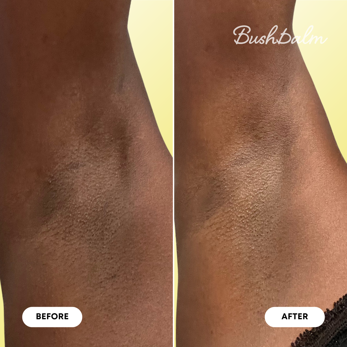 Dark Spot Oil - Bermuda